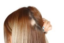 The Truth About Natural Extensions and Hair Loss: