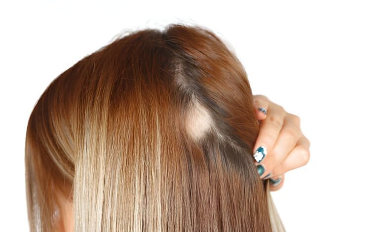 The Truth About Natural Extensions and Hair Loss: